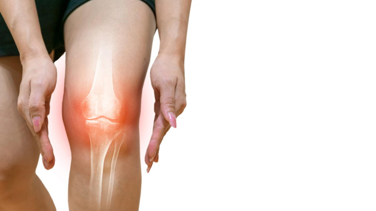 Knee osteoarthritis can develop into a debilitating condition with a marked impact on a person’s overall health and quality of life.